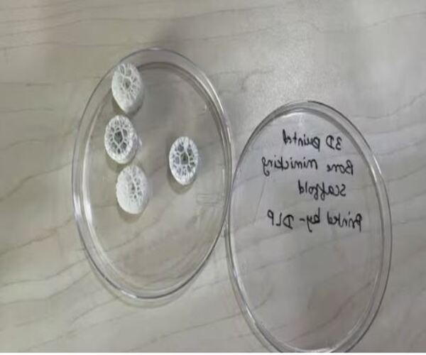 IITમાં બન્યું સિન્થેટિક બોન