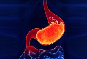 તળેલુ, ગરમ ખાધા પછી શું તમને થાય છે એસિડિટી