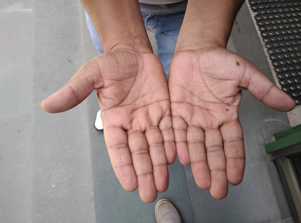 હસ્તરેખાશાસ્ત્ર: શું તમારી હથેળીની મધ્યમાં તલ છે?