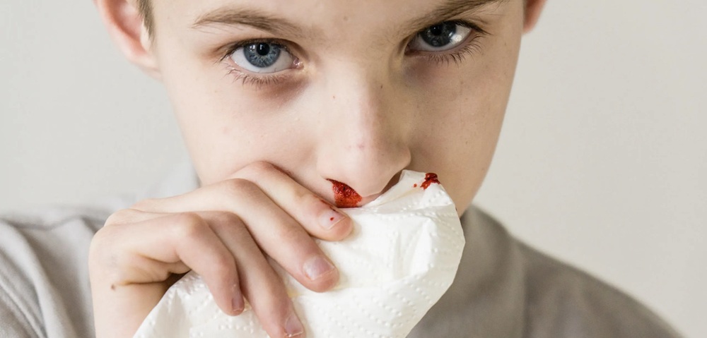 ઉનાળામાં નાકમાંથી કેમ નીકળે છે લોહી?