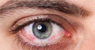 હીટ વેવથી આંખોને થઈ શકે છે મોટું નુકસાન