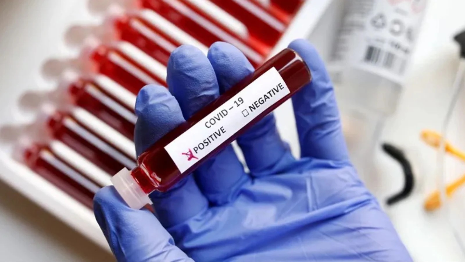 અઢી વર્ષ પછી ઓડિશામાં કોવિડનો કેસ મળ્યો