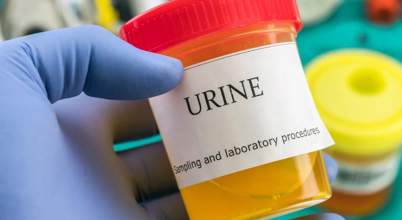 વારંવાર યુરિન જવું પડે એ કયા રોગોનું લક્ષણ?