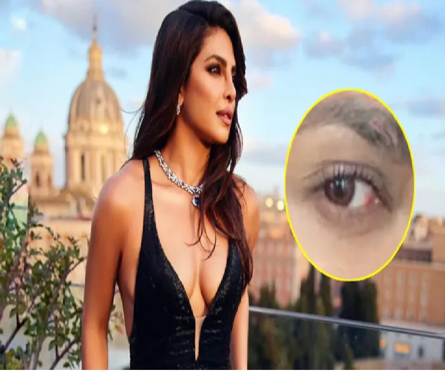 Priyanka Chopraની સાથે થયો મોટો અકસ્માત