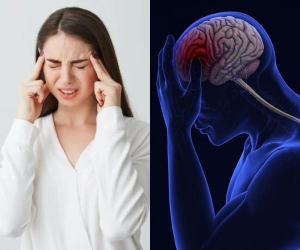 Brain Stroke Symptoms