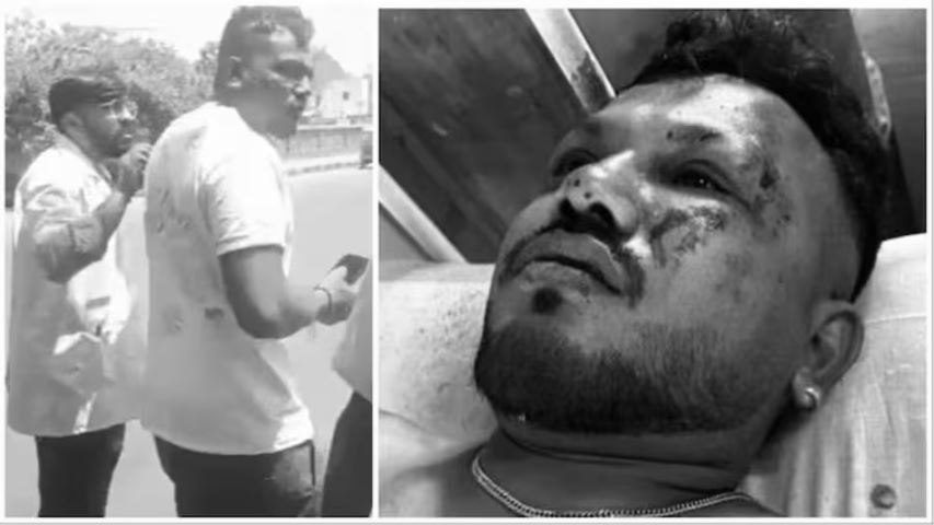 ગુમસુમ થઇ ગયા છે એકમાત્ર પ્લેન ક્રેશ સર્વાઇવર