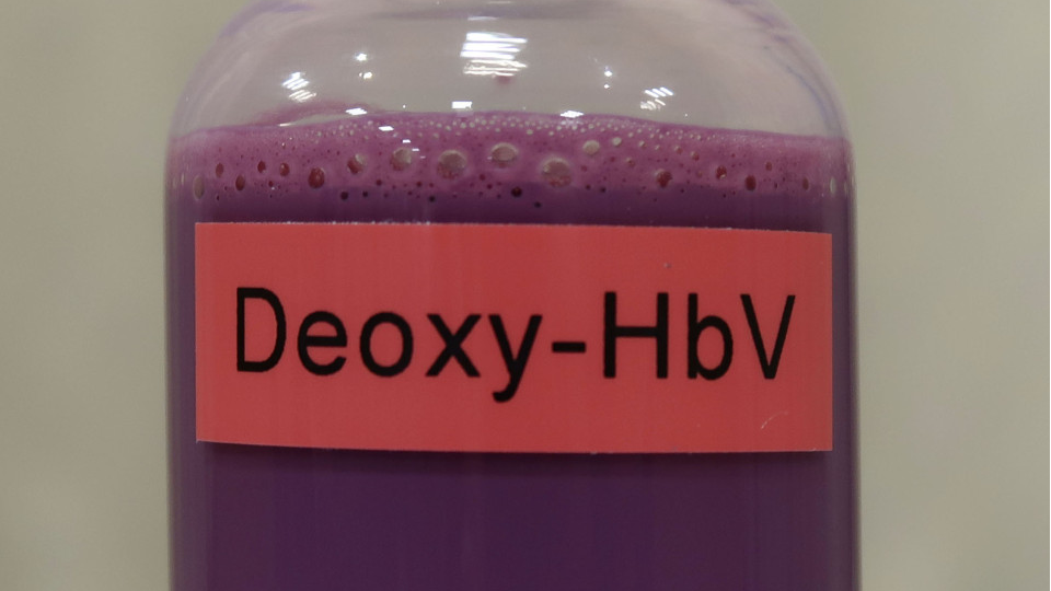 લાલ નહીં જાંબલી રંગનું છે આ લોહી!