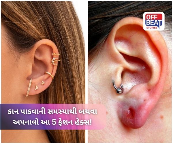 આર્ટિફિશયલ ઈયરિંગ્સ પહેર્યા પછી શું તમારા કાન પાકી જાય છે?
