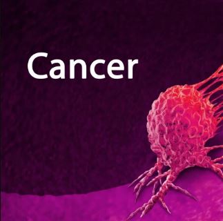 કેન્સર સામે નવી આશા વૈજ્ઞાનિકોએ શોધી કાઢી અનોખી સારવારની પદ્ધતિ