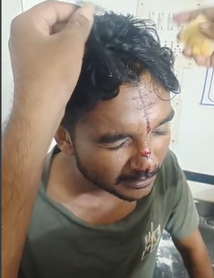 અમદાવાદમાં લુખ્ખા તત્વોનો ત્રાસ યથાવત