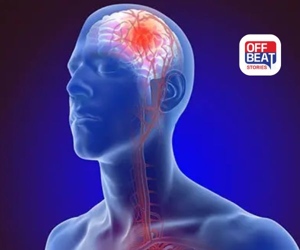 આ લક્ષણો દેખાય તો ચેતજો! થઈ શકે છે બ્રેન સ્ટ્રોક