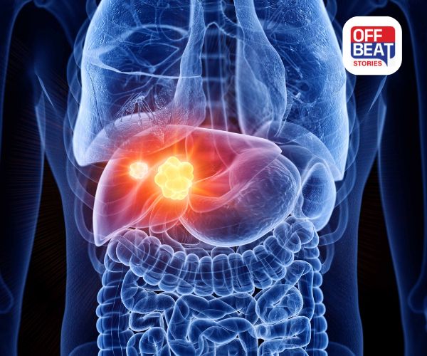 શું તમને તો નથી આ ભયંકર બીમારી?