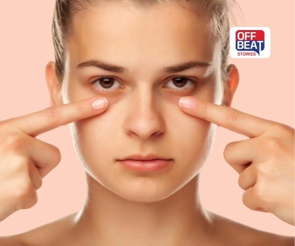 આંખોની નીચે કાળા ઘેરા Dark Circles થી મેળવવા માંગો છો છુટકારો?