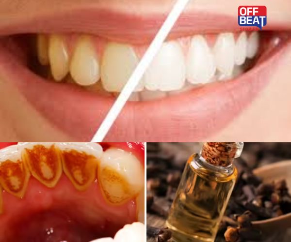 શું તમારા દાંત પીળા અને દુર્ગંધયુક્ત છે?