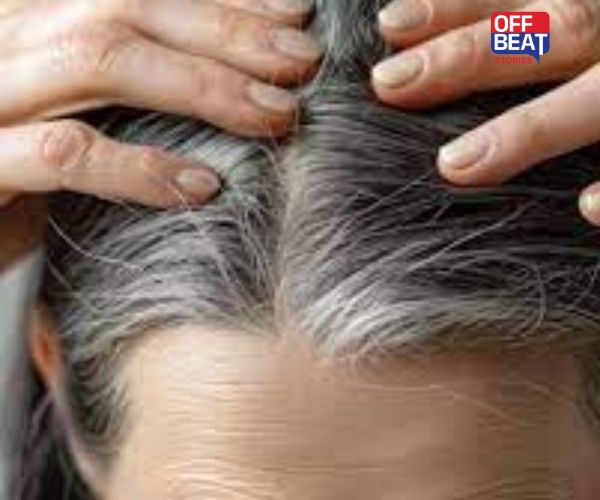 બાળપણમાં કેમ થાય છે વાળ સફેદ?