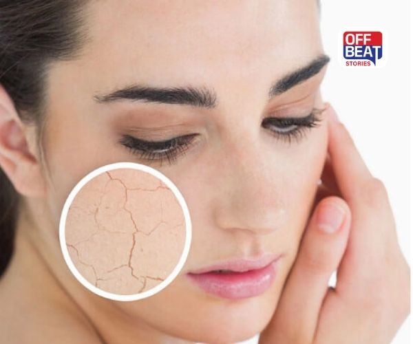 Dry Skin Causes