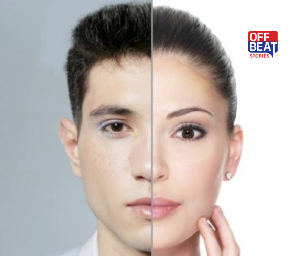 ભારતમાં લિંગ પરિવર્તન સર્જરીનો કેટલો થાય છે ખર્ચ?: જાણો સ્ત્રીથી પુરુષ અને પુરુષથી સ્ત્રી બનવાની સંપૂર્ણ પ્રક્રિયા