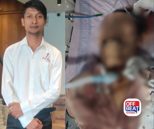 રાજકોટ સિવિલ કેસમાં મોટું અપડેટ