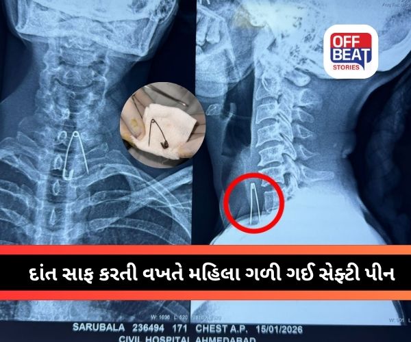 સિવિલ હોસ્પિટલ અમદાવાદમાં ઈએનટી ડોક્ટરોની કુશળતા