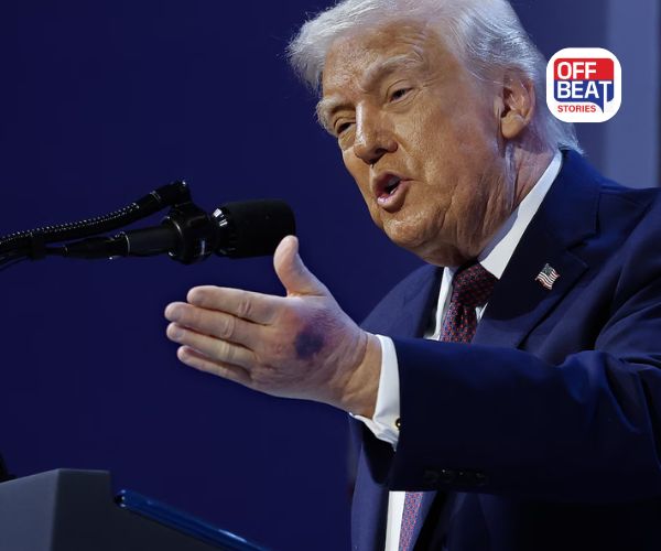 ટ્રમ્પને આ કઈ બીમારી છે?