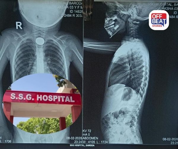 વડોદરાની સયાજી હોસ્પિટલમાં એક જ દિવસમાં બે જીવલેણ કિસ્સા