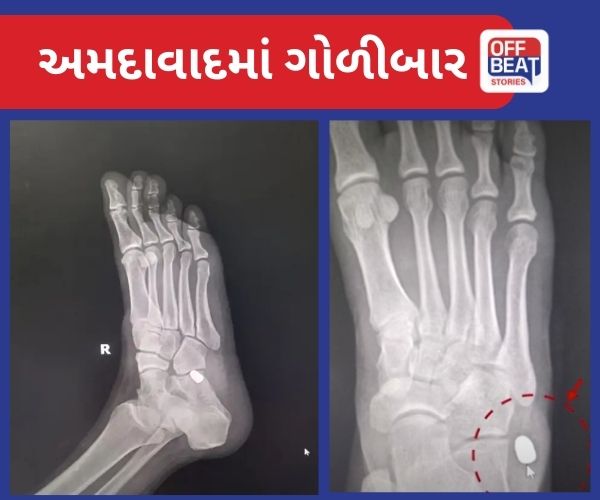 અમદાવાદમાં મોડી રાત્રે બે રાઉન્ડ ફાયરિંગ