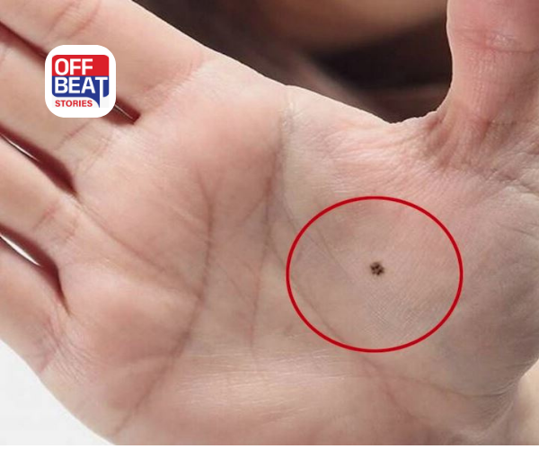 શું તમારા શરીર પર પણ છે આ ખાસ જગ્યાઓએ તલ?