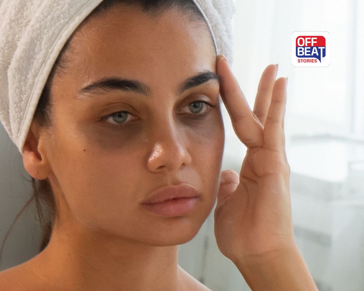 આંખો નીચેના કાળા કુંડાળાથી છો પરેશાન?