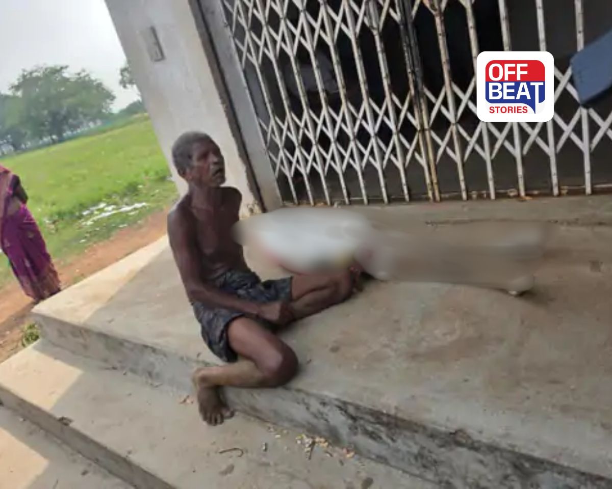 બહેનનું હાડપિંજર લઈને બેંક પહોંચ્યો આ ભાઈ