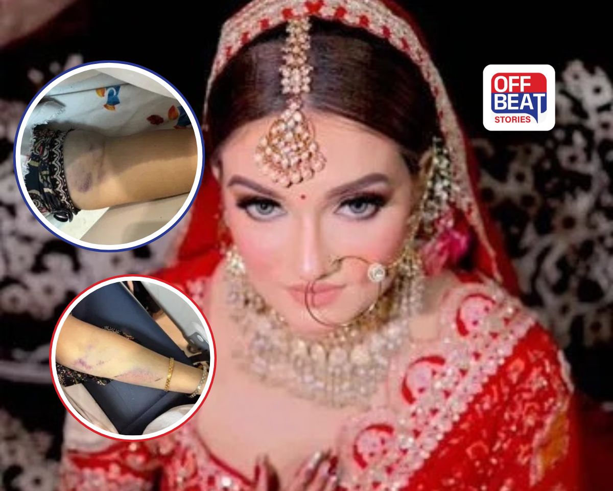 Noida Dowry Case Deepika Nagar
