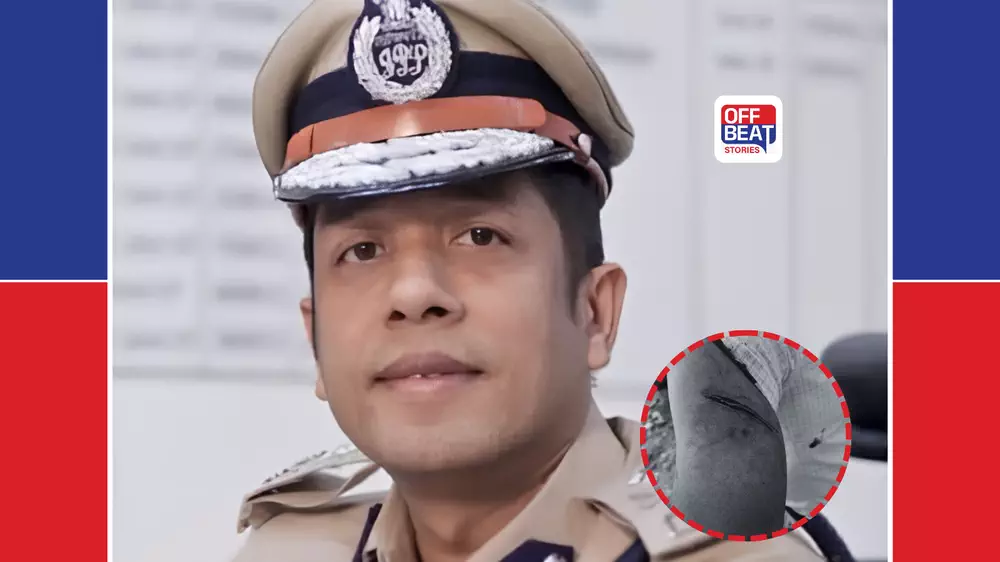 અમદાવાદમાં હિસ્ટ્રીશીટર કલીમની ધરપકડ બાદ JCP પર જીવલેણ હુમલો