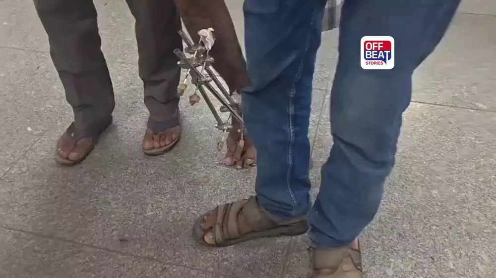 વડોદરાની SSG હોસ્પિટલની ઘોર બેદરકારી