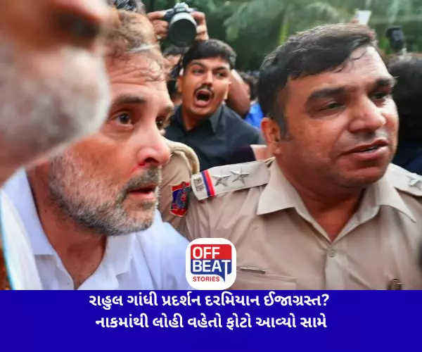 રાહુલ ગાંધી પ્રદર્શન દરમિયાન ઈજાગ્રસ્ત?